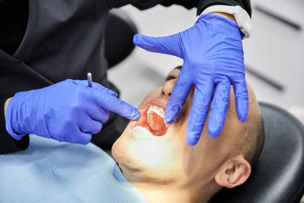 Best Emergency Dental Care for Sports Injuries in Palmetto Bay, FL